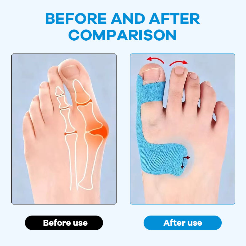 Precut Bunion Corrector Tape for Big Toe Support and Pain Relief