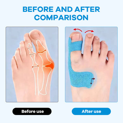 Precut Bunion Corrector Tape for Big Toe Support and Pain Relief