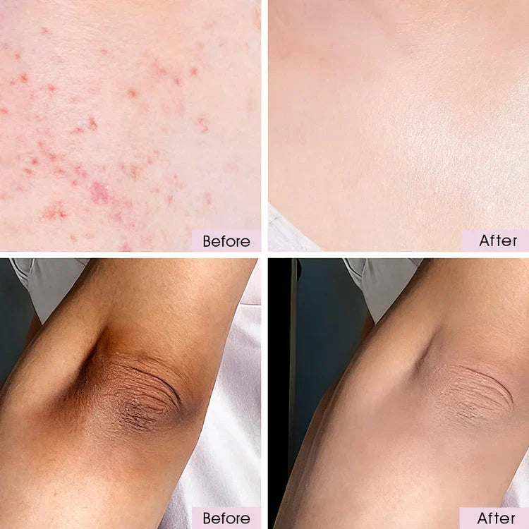 Peel Shot - Kojic + Turmeric Body Peel Spray