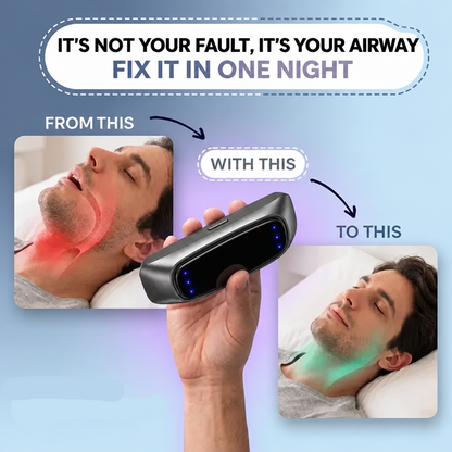 Smart Anti-Snoring Device -  Limited-Time Buy 1 Get 1 Free 😴🌙