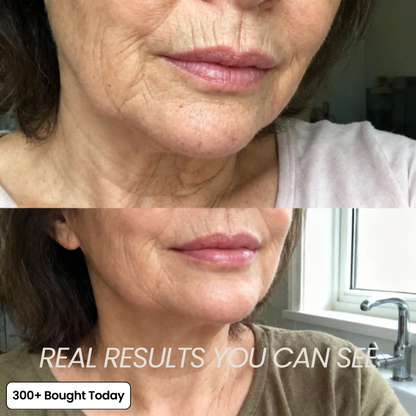 Femmekin™ Transform Wrinkles- Collagen Eye Stick