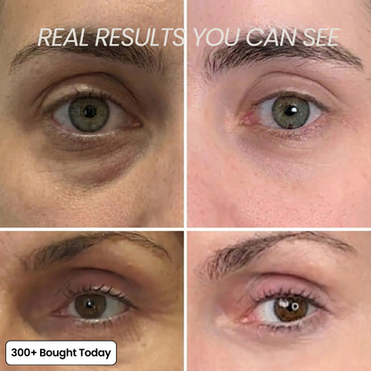 Femmekin™ Transform Wrinkles- Collagen Eye Stick